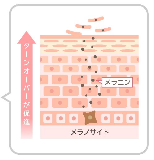 シミが浮き上がるターンオーバーの仕組み