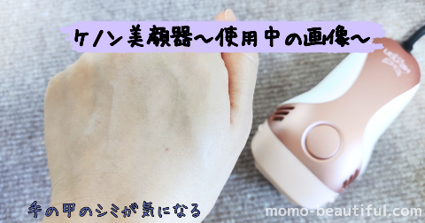 ケノン美顔器の使用中の画像